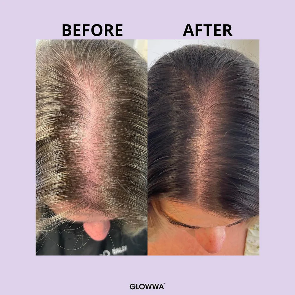 GLOWWA Menopause Hair Growth Supplements - Lisa Thompson Aesthetics