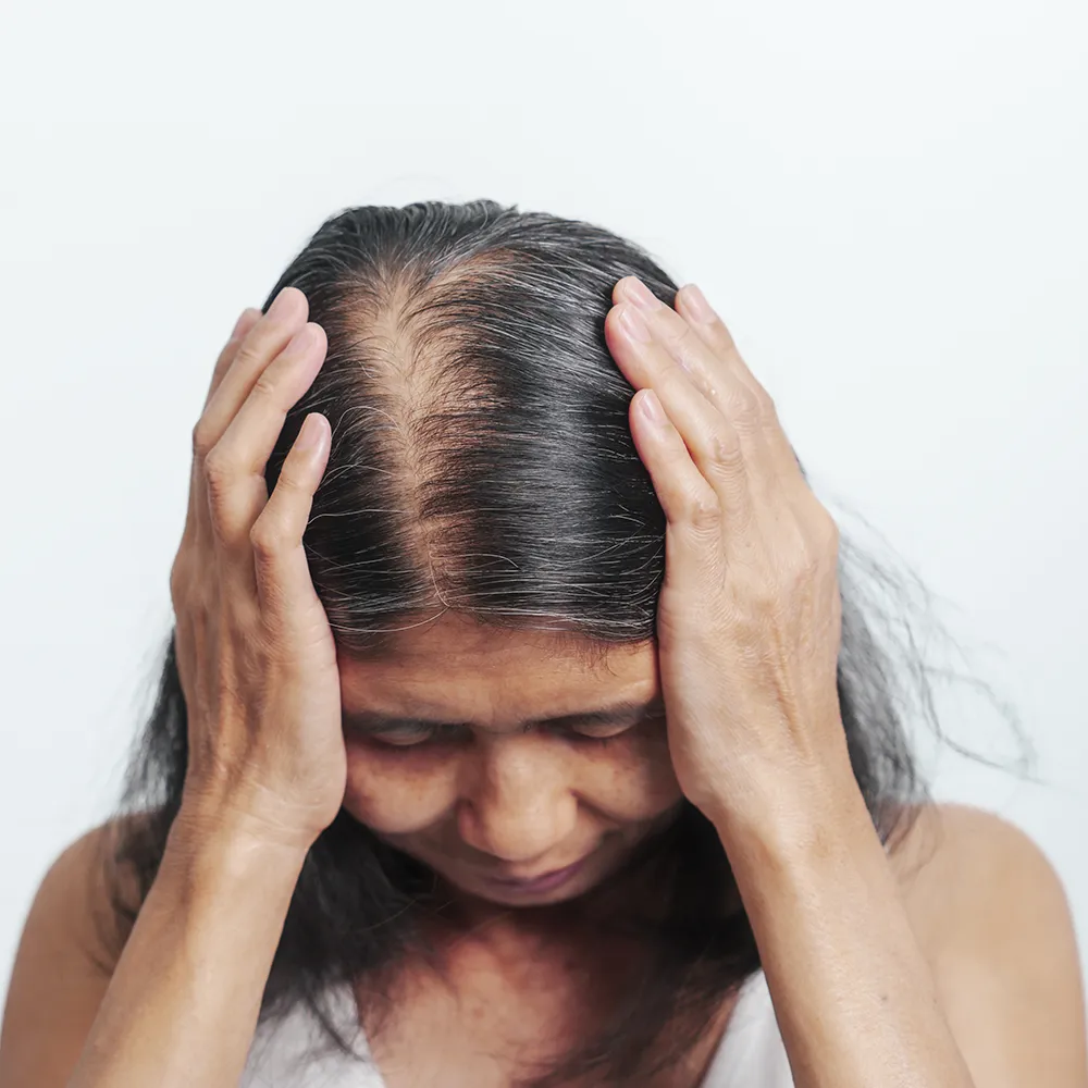 Hair Thinning & Regrowth - Lisa Thompson Aesthetics