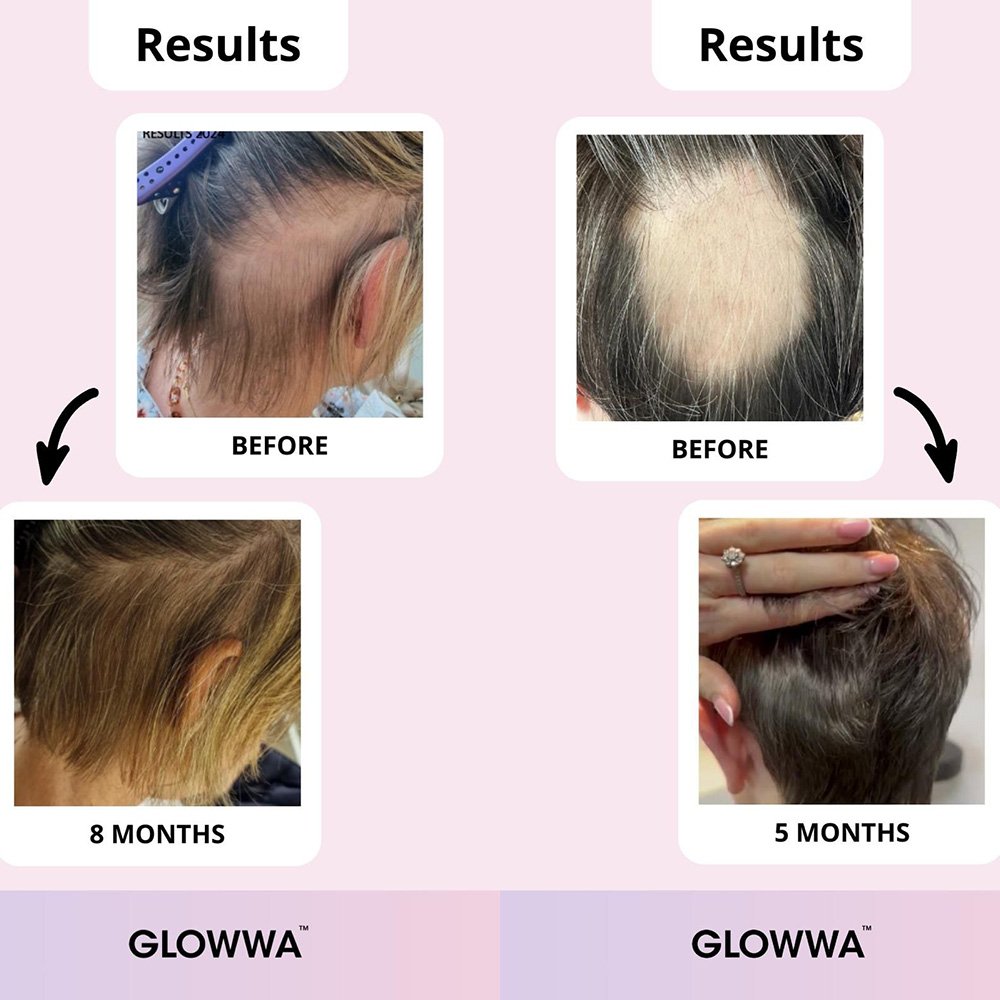 Glowwa Hair Food - Lisa Thompson Aesthetics