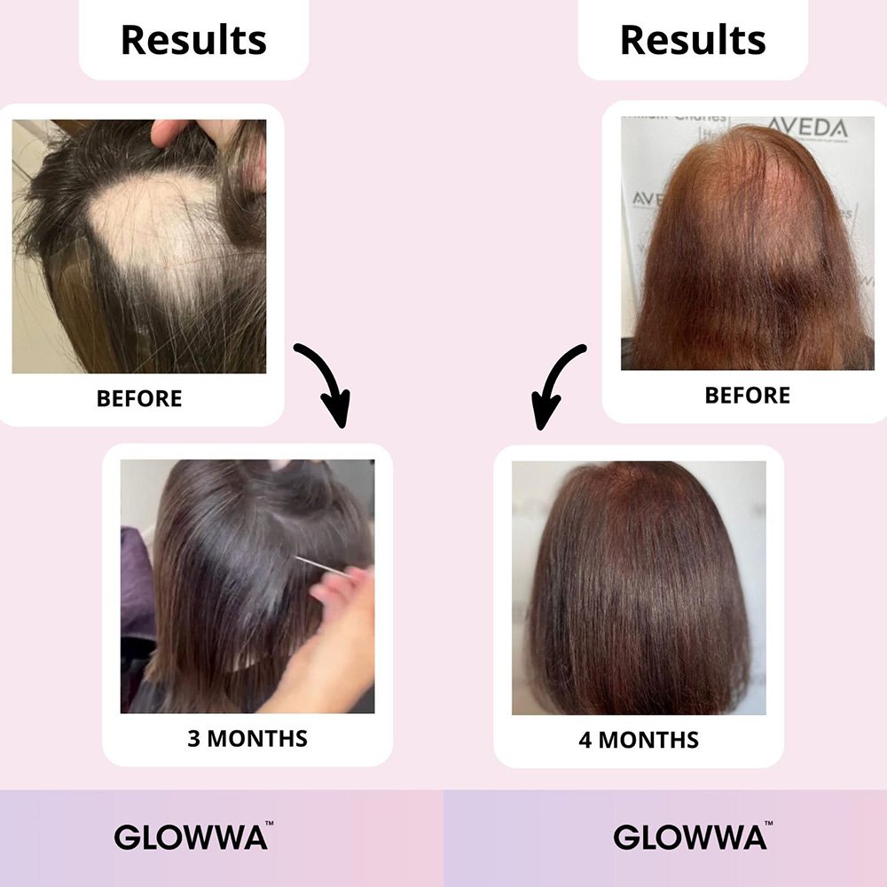Glowwa Hair Food - Lisa Thompson Aesthetics