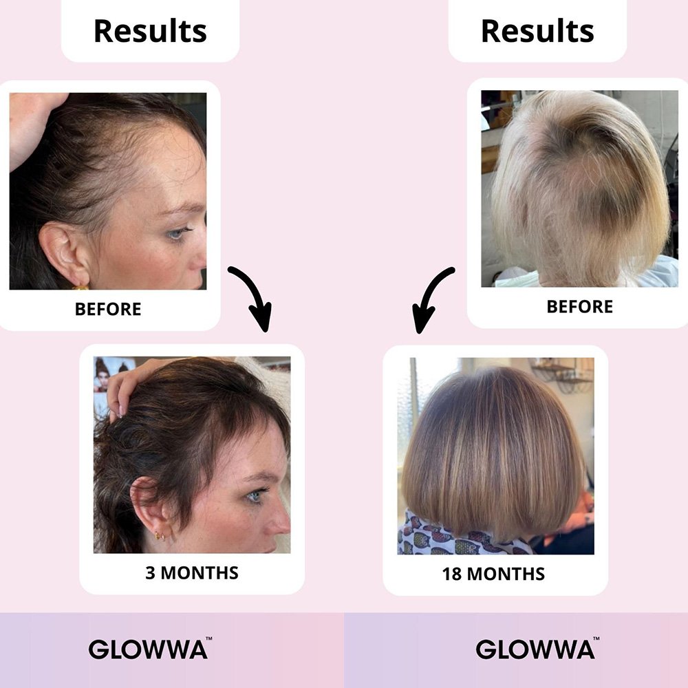 Glowwa Hair Food - Lisa Thompson Aesthetics